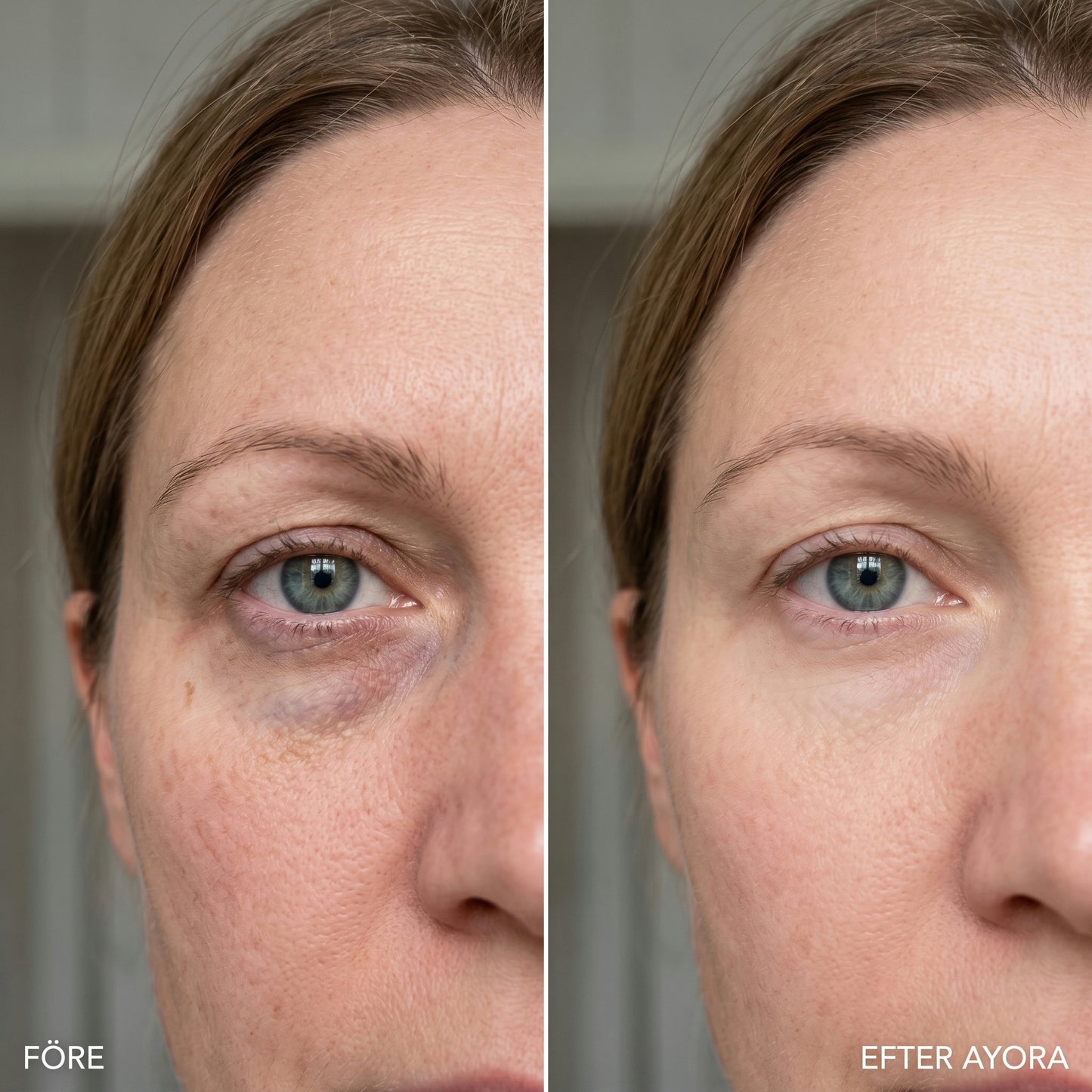 AYORA™ Morning Reset Eye Patches