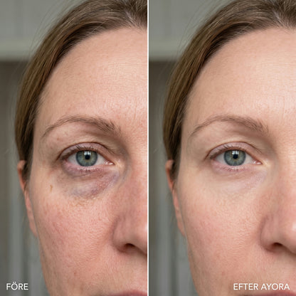 AYORA™ Morning Reset Eye Patches