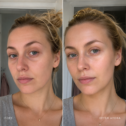 AYORA™ Morning Reset Eye Patches